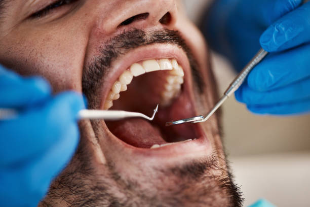 Best Tooth Extraction  in Eaton, OH