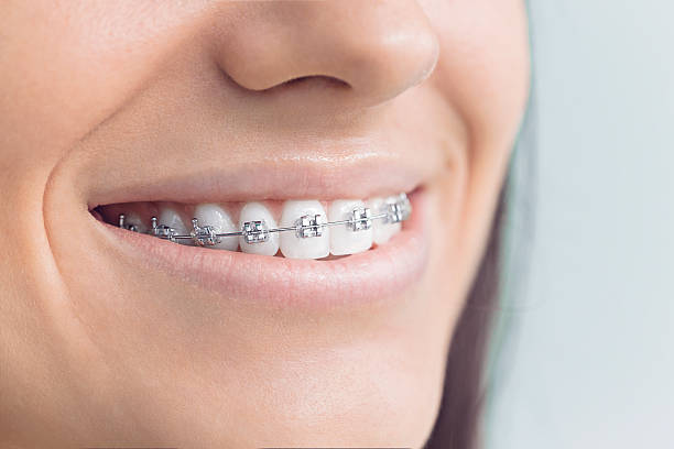 Best Full Mouth Reconstruction  in Eaton, OH